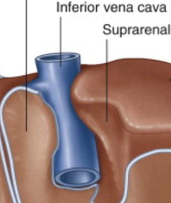 <p>Which liver lobe sits directly against the IVC?</p>