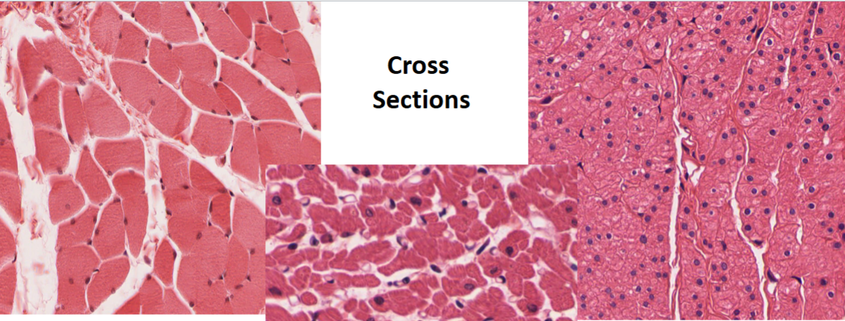 <p>Muscle Cross Sections</p>