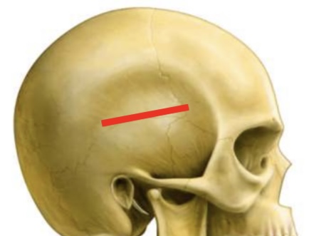 <p>Temporal bone </p>