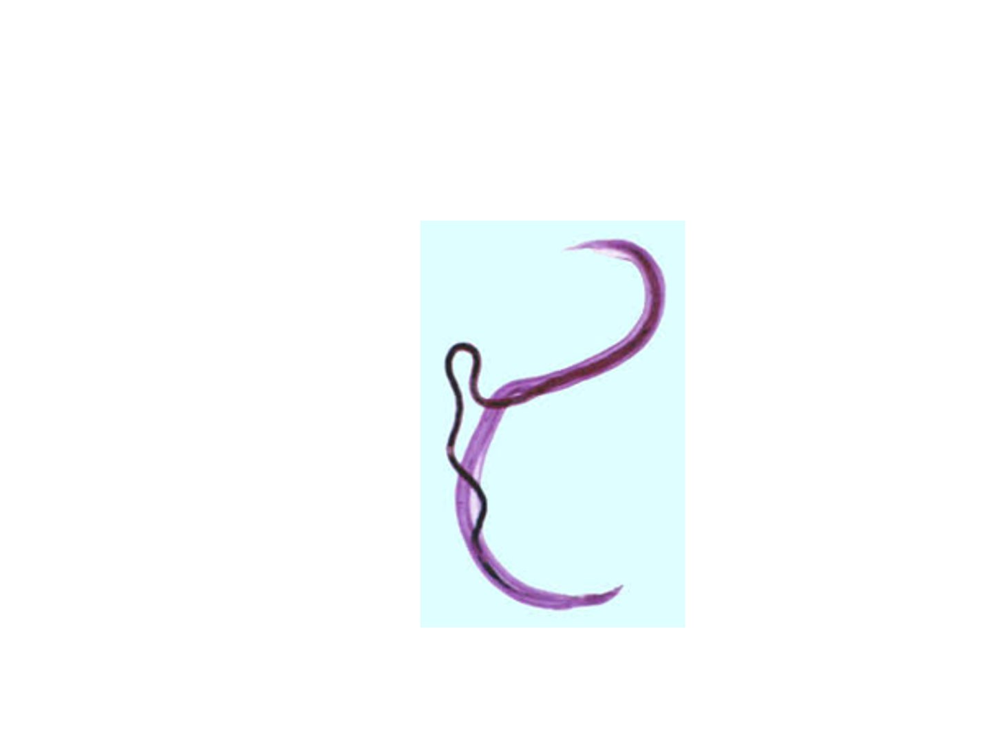 <p>Identify this worm in which the female lives inside the gynecophoral canal of the male</p>