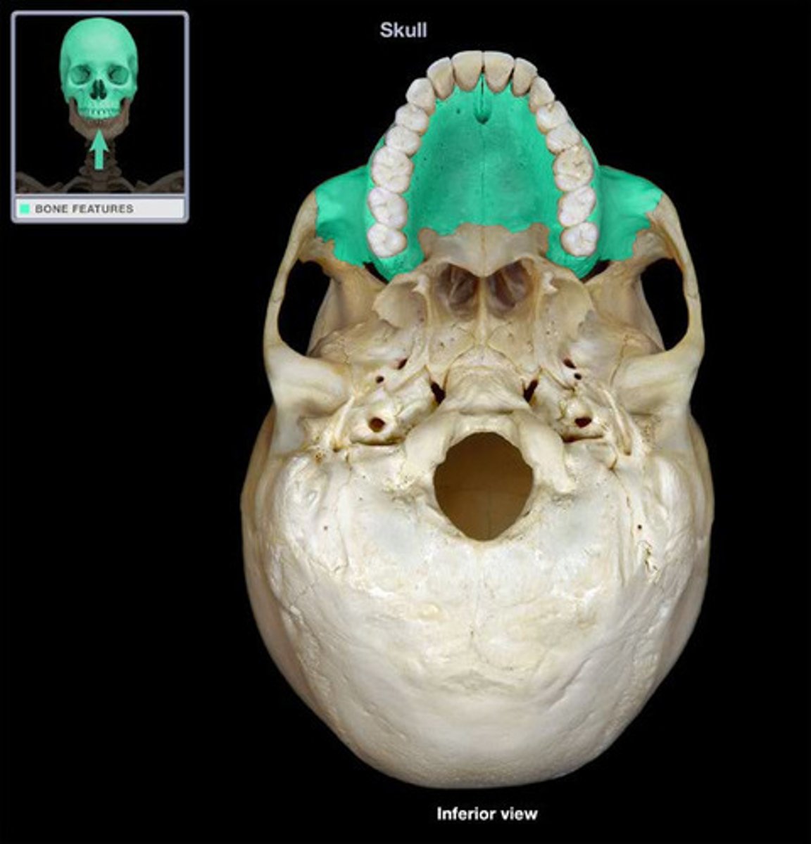 <p>ID highlighted bone</p>