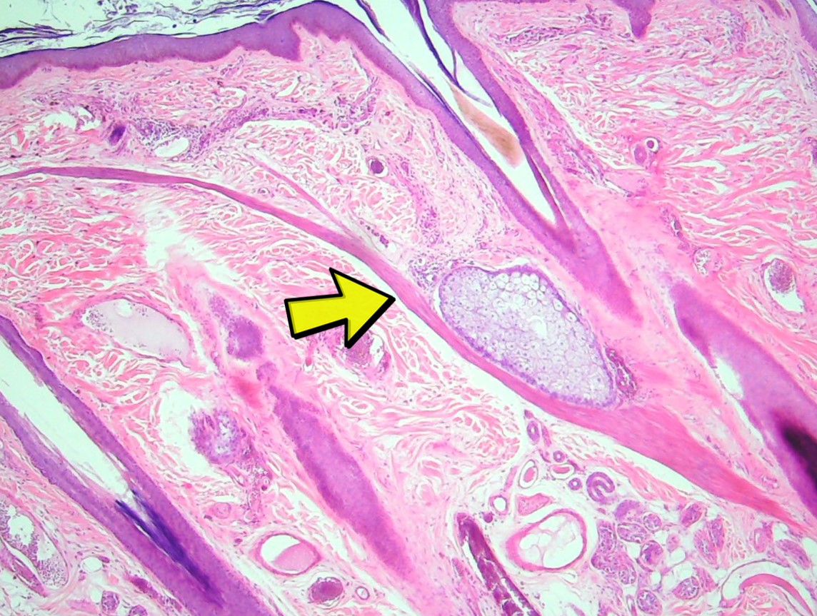 <p><span>Identify the structure in the micrograph at the yellow arrow?</span></p>