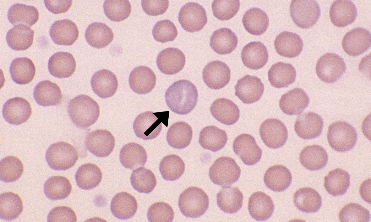 <p>immature RBC that are purple/blue on stain due to increased RNA in structure </p>