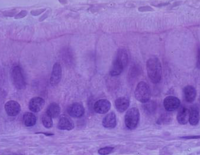 <p>tissue type </p>