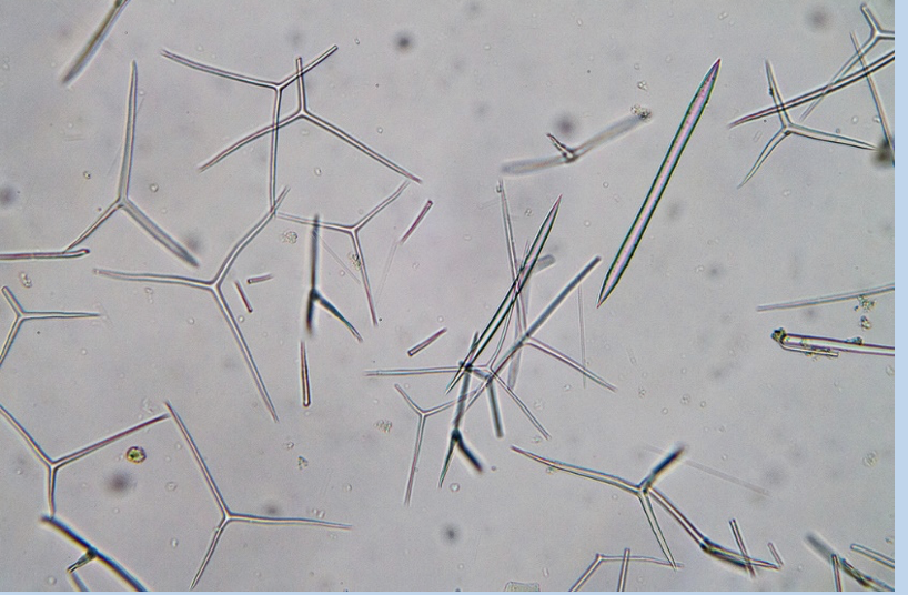 <p>The internal support structures found in Porifera (sponges), function as an endoskeleton </p>
