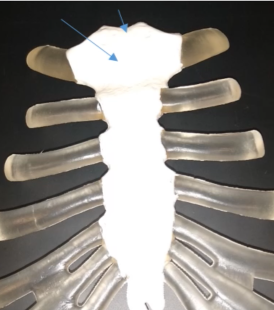 <p>What is this very top dip on the sternum</p>