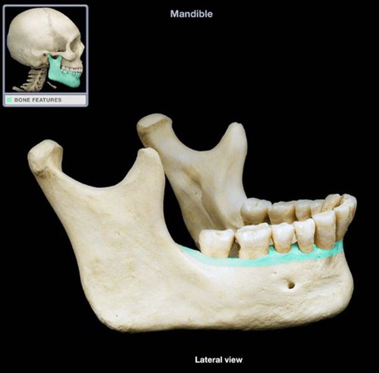 <p>socket/cavity where the root of the tooth is held</p>