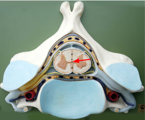 <p>Contains CSF and is continuous with the 4th ventricle</p>