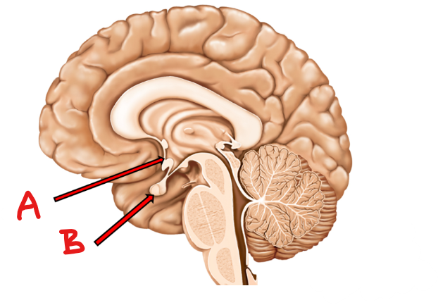 <p>identify A and B</p>