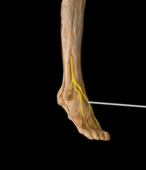 <p>Innervates muscles of the lateral compartment of the leg.</p>
