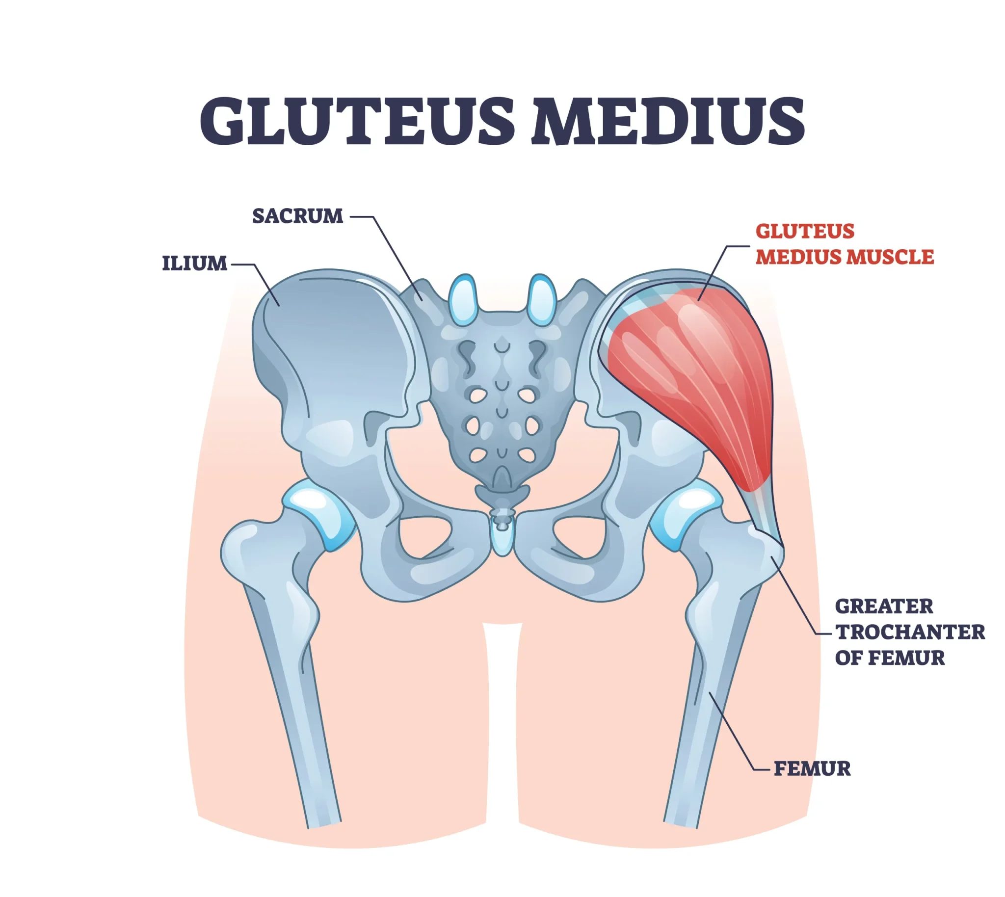 <p>External surface of ilium between anterior and posterior gluteal lines</p>