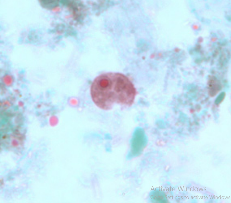 <ol><li><p>Iodamoeba buetschlii</p></li><li><p>Trophozoite</p></li></ol><p></p>