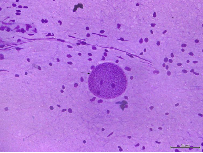 <p>what stage of toxoplasma gondii is shown?</p>