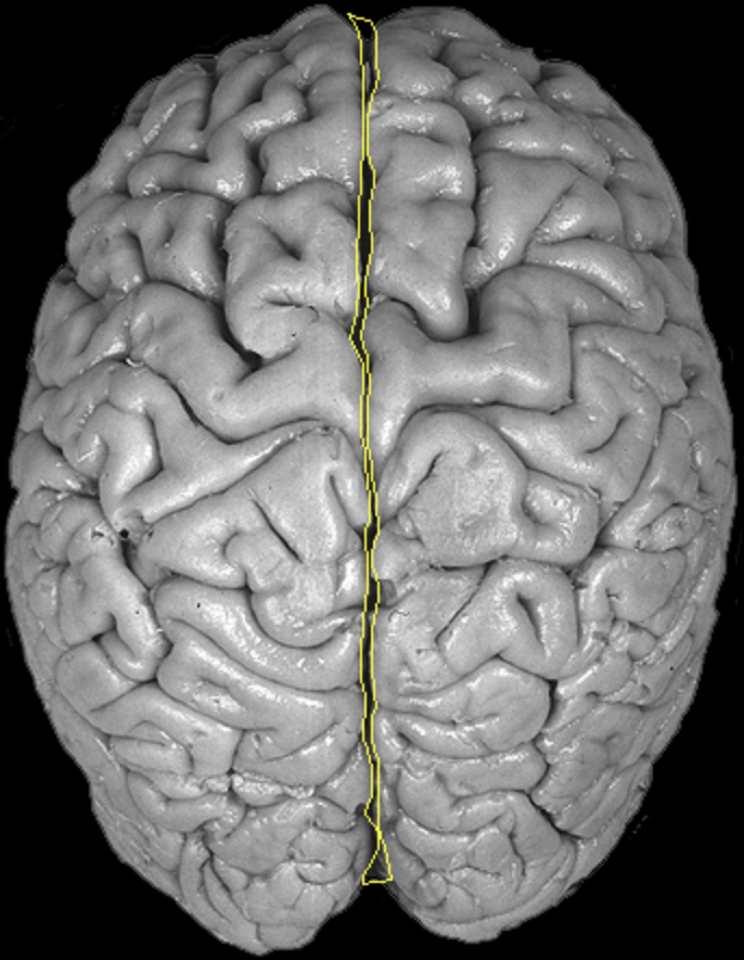 <p>What is the area highlighted called?</p>
