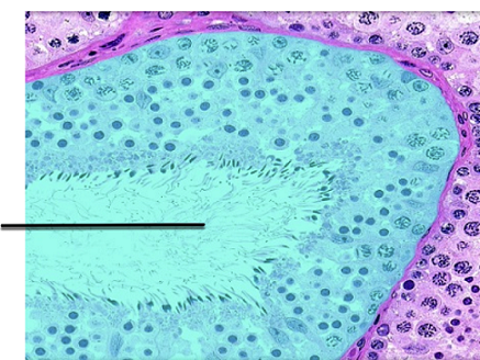<p>what structure is highlighted?</p>