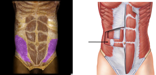 <p>bilateral trunk flexion, unilateral flex and rotate the trunk to the same side</p>