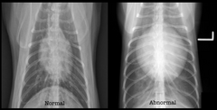 <p>What two Roentgen signs are important when evaluating the abnormal image?</p>