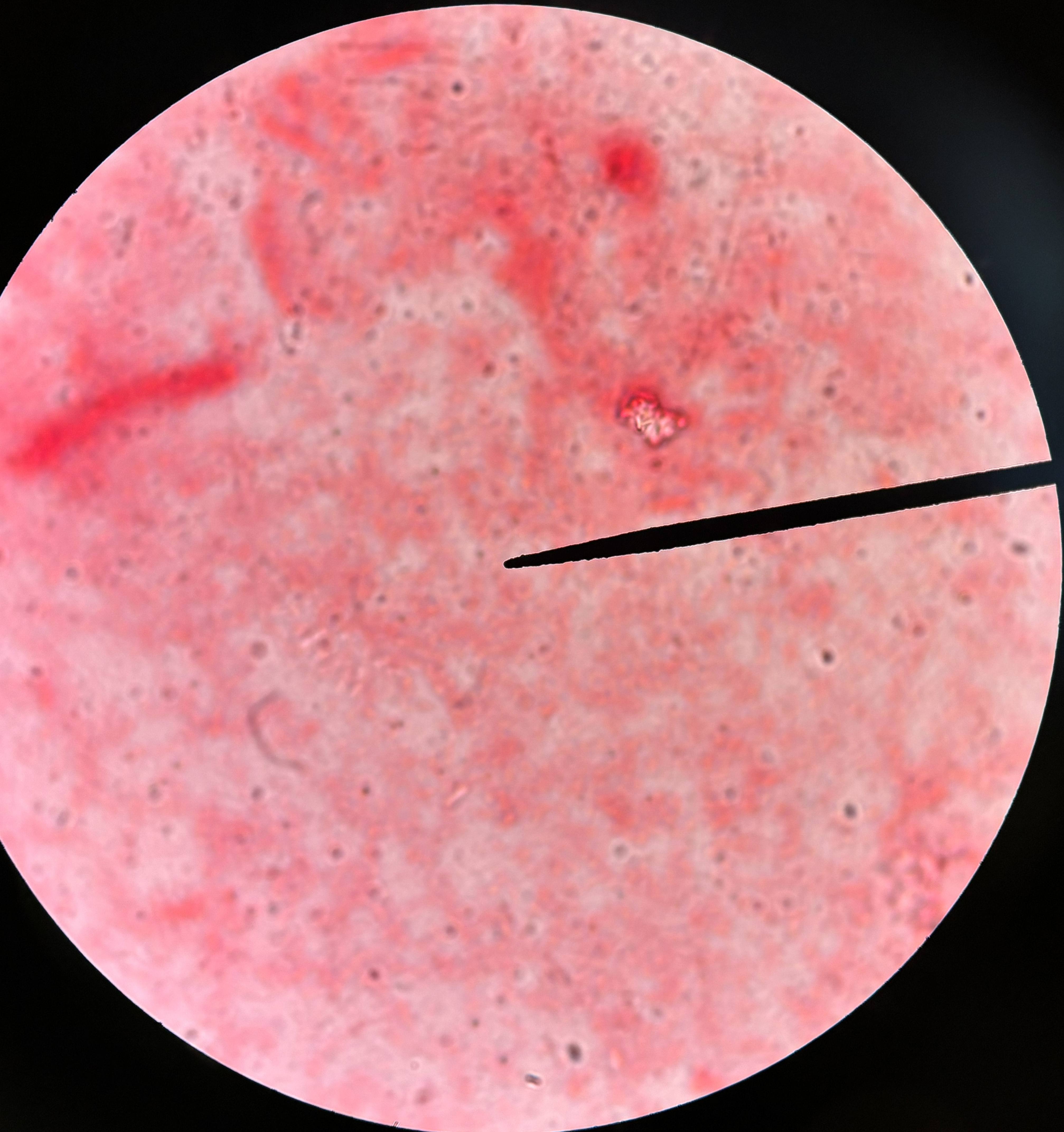 <p>This is <em>E.Coli</em>. Is it gram-positive or gram-negative?</p>