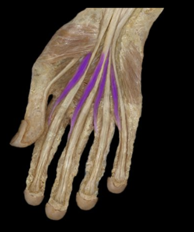 <p>What the highlighted structure is acting on the <strong><mark data-color="#5f61e2" style="background-color: rgb(95, 97, 226); color: inherit;">Midpalmar Group</mark>.</strong> What muscle is this called?</p>