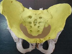 <p>ends at terminal parts of the colon</p>