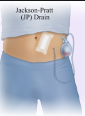 <p>Secure the drain to the patient's gown.</p>