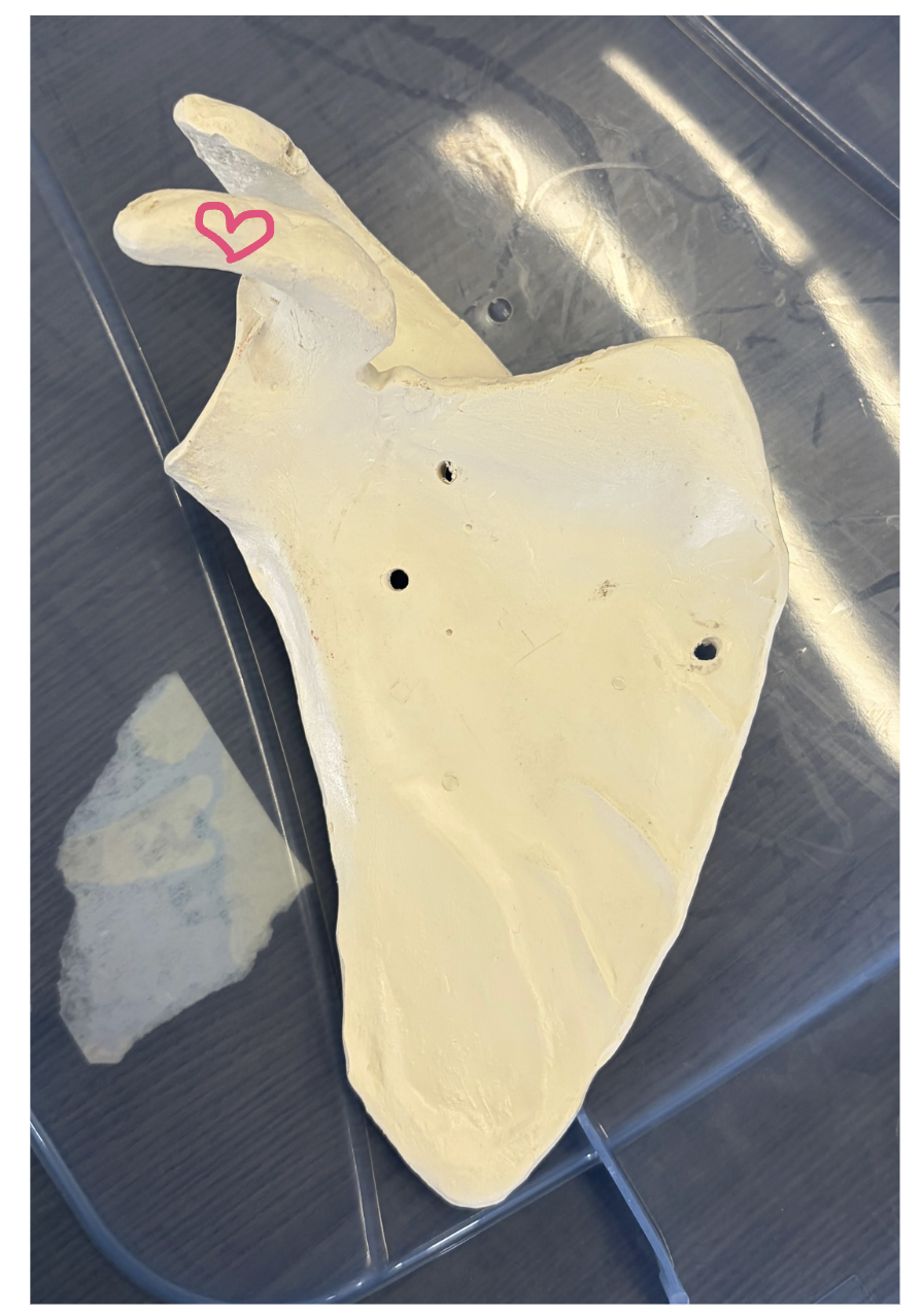 <p>Pink heart: Name the structure the heart is on</p><p>Name 1 muscle that originates here</p><p>Name 1 muscle that inserts here</p><p>What shoulder actions occur based on the muscle that inserts here?</p>