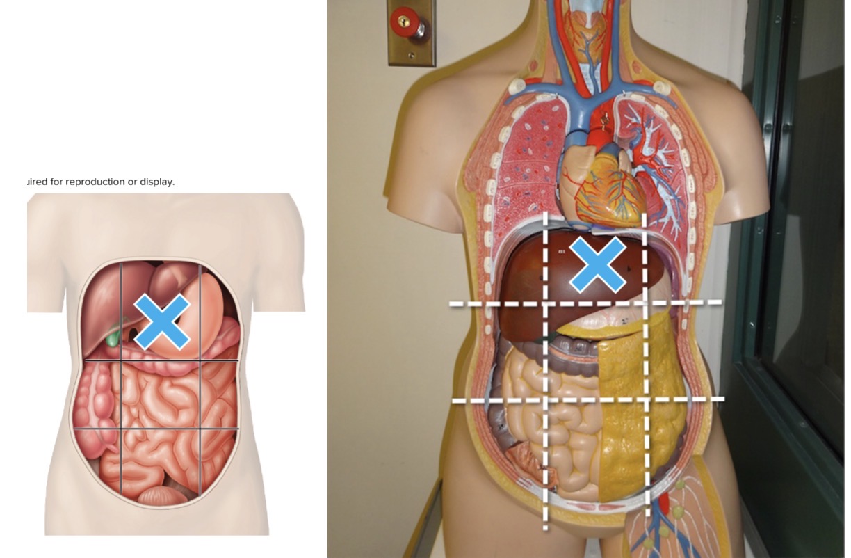 <p>Name the abdominopelvic region the mark is in</p>