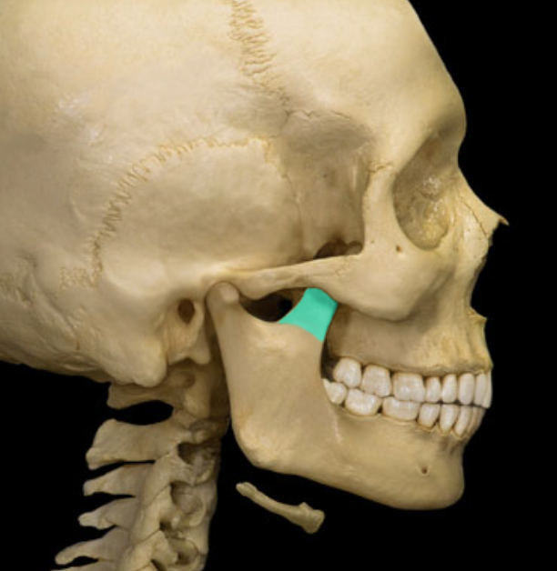 term image