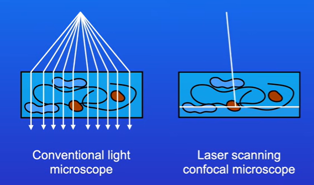 <p>A laser is used to scan the object that we’re interested in, this allows us to view a very precise layer of the object</p><p>This also results in a higher resolution than conventional light microscopes.</p><p>We can also produce 3d images of cells.</p>