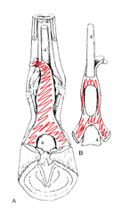 <p>what is the sleeve formed by the superficial digital flexor tendon called?</p>