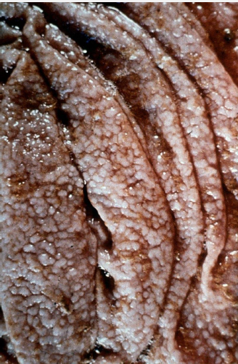 <p><span style="color: blue;">This “Moroccan leather” appearance of abomasal mucosa on necropsy is due to what nematode infection?</span></p>