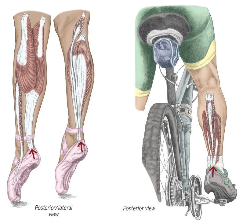 <p><span>Gastrocnemius</span></p><p style="text-align: left;"><span>Soleus</span></p><p style="text-align: left;"><span>tibialis posterior</span></p><p style="text-align: left;"><span>fibularis longus</span></p><p><span>fibularis brevis</span></p>