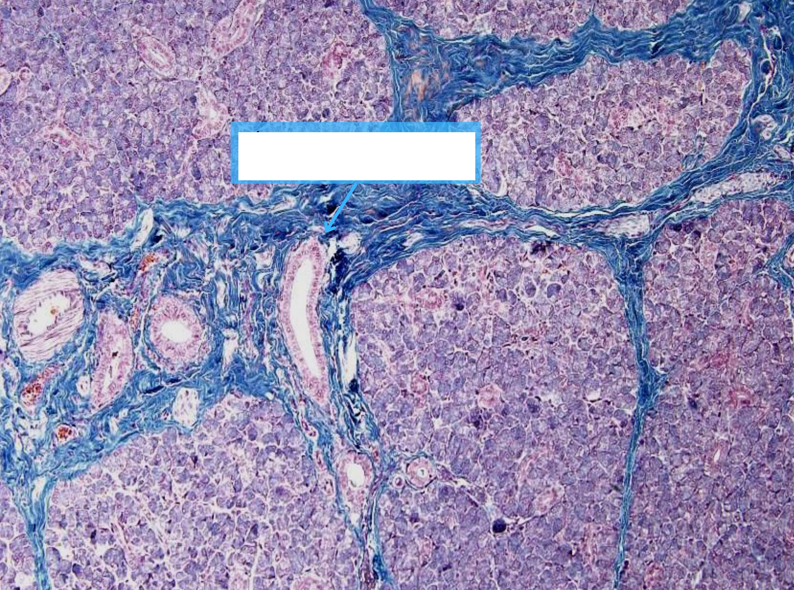 <p>Cấu trúc gì ?</p>