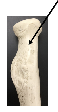 <p>What bone and bone feature is this?</p>