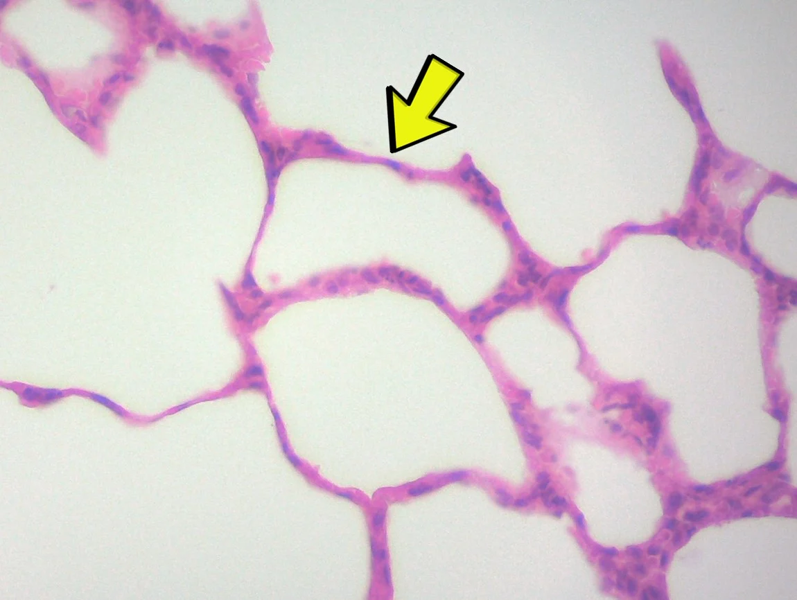 <p><span>Identify the tissue type in the micrograph at the yellow arrow.</span></p>