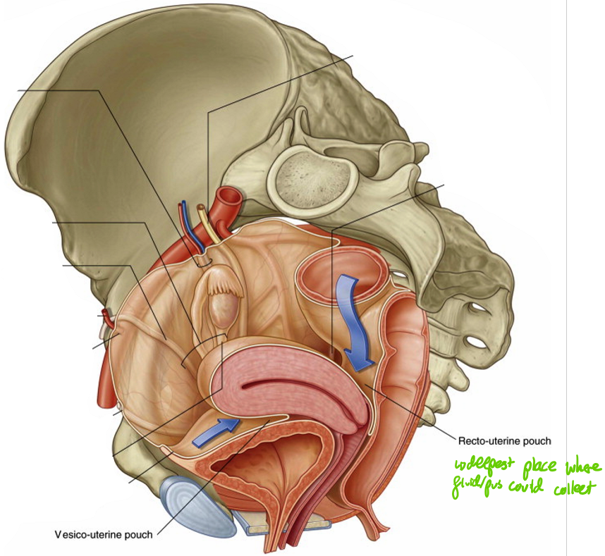 <ul><li><p><strong>Peritoneal pouches</strong>: where the peritoneum reflects over pelvic organs, forming pouches</p><ul><li><p><strong>Vesicouterine pouch</strong>: the pouch between the bladder & uterus</p></li><li><p><strong>Rectouterine pouch</strong> (<em>pouch of Douglas</em>); the pouch between the uterus & r3ctum</p></li></ul></li><li><p>Clinically relevant due to <em>fluid accumulation sites</em> (more common in rectouterine poch - deeper)</p></li></ul><p></p>