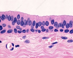 <p>Epithelial cells. Tightly packed, tall rectangular cells in many layers</p>