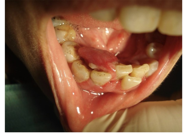 <p>CHẨN ĐOÁN?</p>