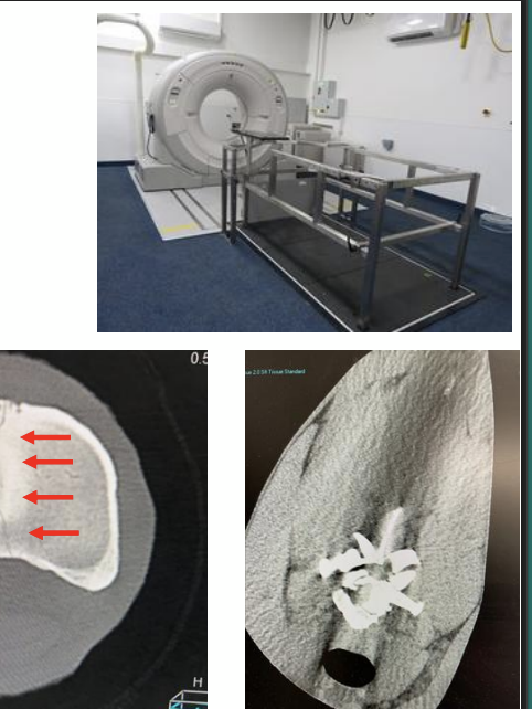 <p>What imaging technique (abbreviated) produces a 3D image using x-rays taken around a single axis of rotation? It allows detailed visualization of interior structures like bone, but is less effective for soft tissue. Standing or GA are required. It is indicated for sinus/teeth/neuro cases, neck ataxia/trauma, limb fractures/subchondral problems/OA/OCLL, and for OA/SI disease in small horses and ponies. It is expensive and requires expert training, and involves radiation.</p>