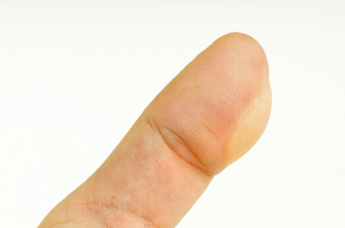 <p>A small bubble on the skin filled with serum, typically caused by friction. An image could show a blister on skin.</p>
