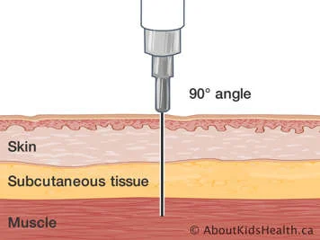 <p>90 degrees</p><p>many vaccines</p>