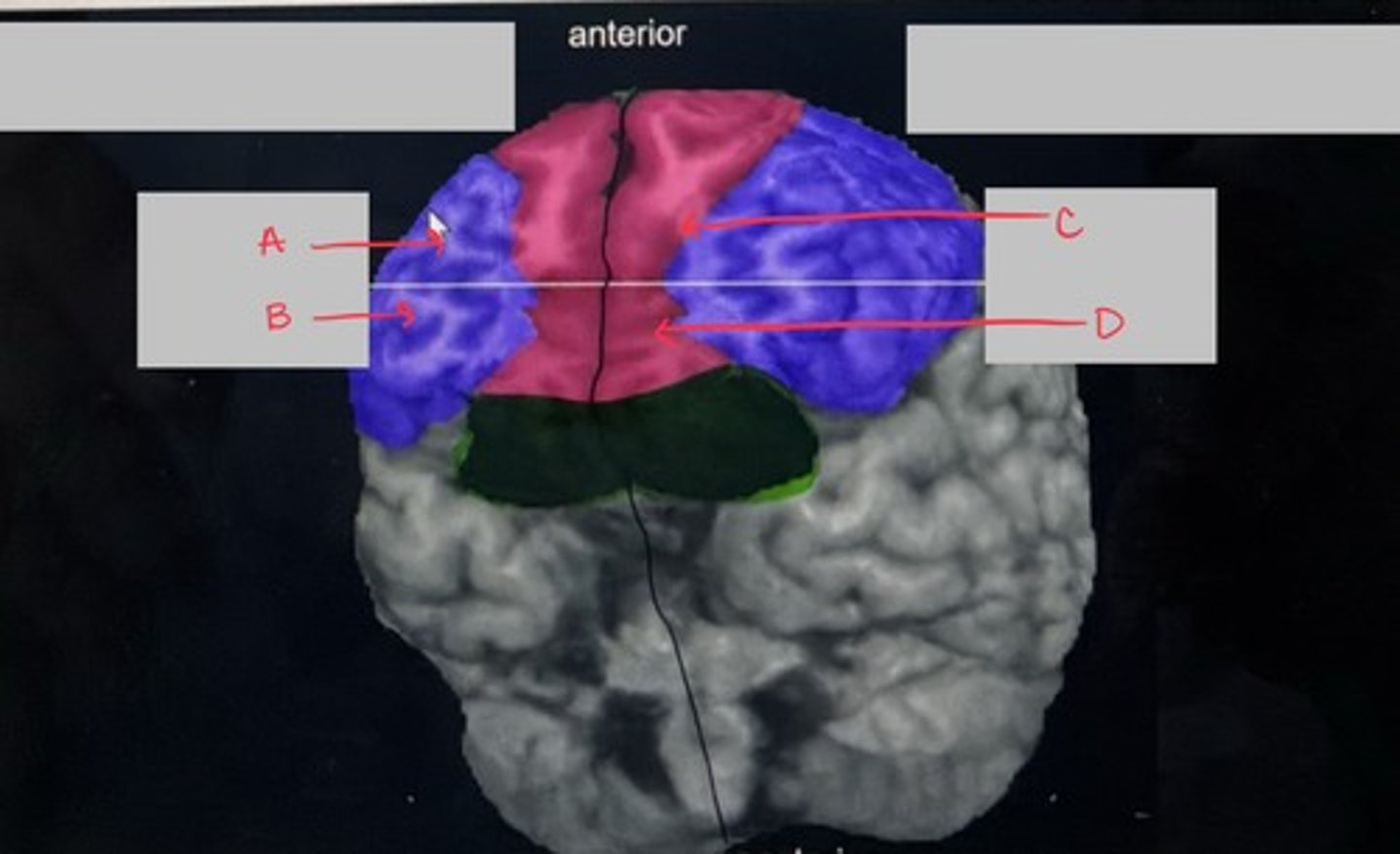<p>What is the pink portion of the brain?</p>