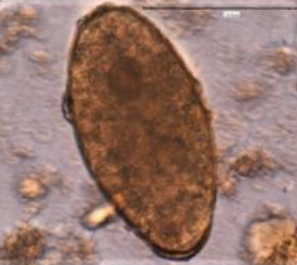 <ul><li><p>yellow-brown</p></li><li><p>small operculum</p></li><li><p>approx. 130-150 × 60-90 microns </p></li><li><p>important!!!!</p><ul><li><p>EGGS INDISTINGUISHABLE FROM F. BUSKI</p></li><li><p>report as “F. buski/F. hepatica egg”</p></li></ul></li></ul><p></p>