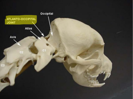 <p>Q: The Atlanto-Occipital Joint is known as the "……" </p><p>A. No Joint </p><p>B. Maybe Joint </p><p>C. Hinge Joint </p><p>D. Yes Joint</p>