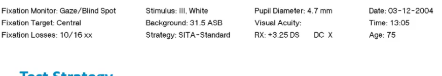 <p>name </p><p>ID </p><p>which eye tested </p><p>DoB </p><p>also has test information: eg what test is done,like central 24-2 threshold tets </p><p></p>