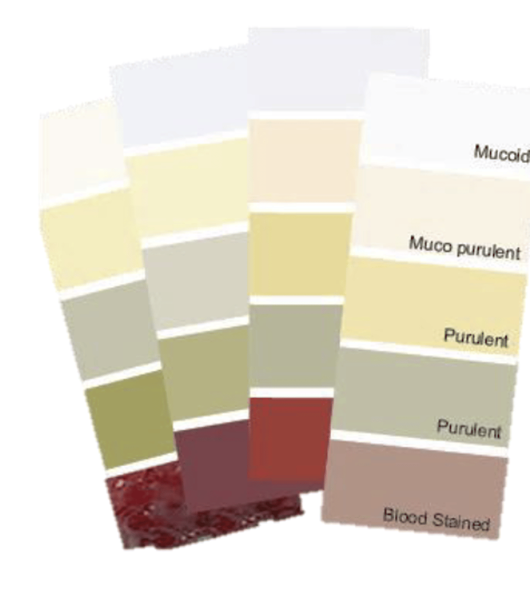 <p>- mucoid: mucus only, white or clear discharge, does not mean bacterial infection, mainly allergic or viral issue</p><p>- muco purulent: combines mucus with purulent discharge, indicates bacterial infection</p><p>- purulent: indicates bacterial infection</p><p>- green purulent: specific species of bacterial</p><p>- blood stained: dealing with hemorragic conjunctivitis, usually caused by virus</p>
