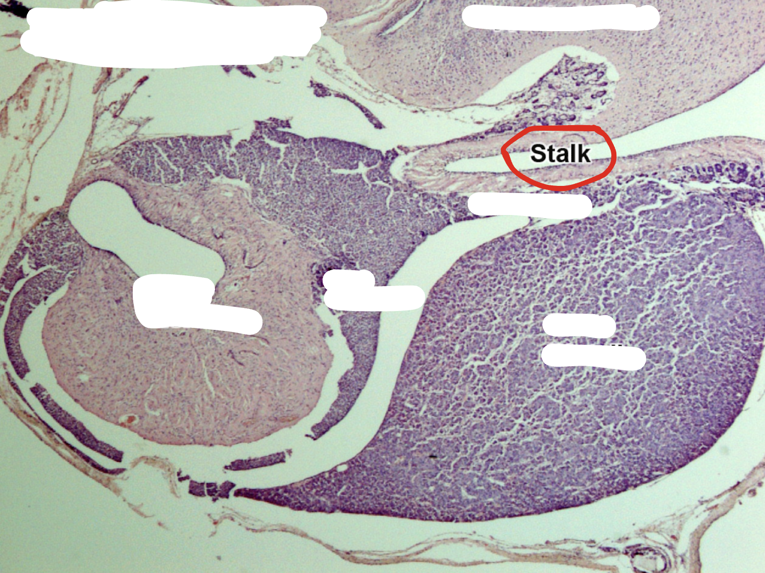 <p>Stalk</p>