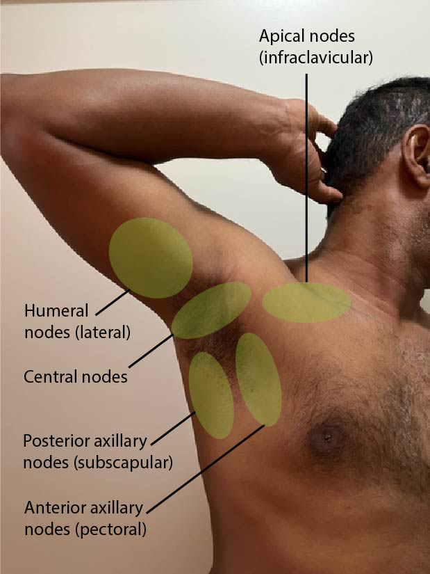 <p>5 different groups of axillary nodes     </p><p></p><p><span>Drains the skin and superficial fascia of everything above the umbilicus (like the breast tissue)</span></p>