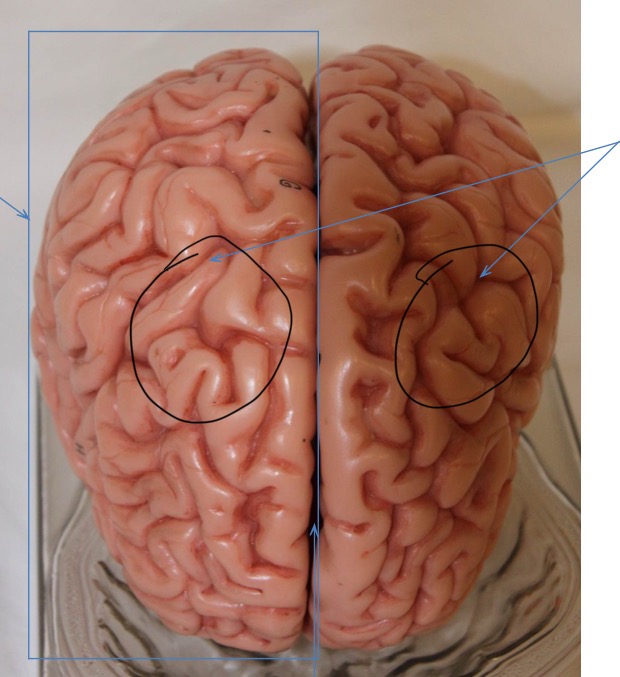 <p>Identify the circled area?</p>