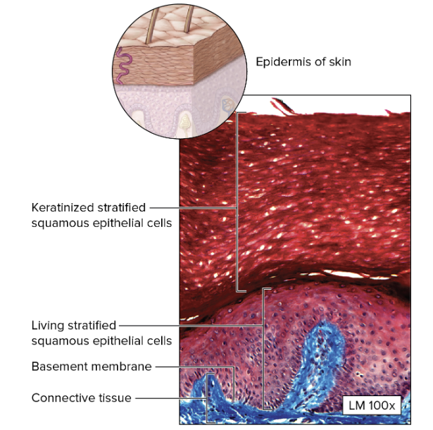 <ul><li><p>darker stained surface</p></li><li><p>consists of an epithelium with many layers of cells</p></li><li><p>layer closer to the basement membrane appear darker and more rounded</p></li><li><p>layers closer to free surface: lighter, flattended, indistinct</p></li><li><p>basement membrane: wavy or rolling, not parallel to apical surface</p></li></ul><p></p>